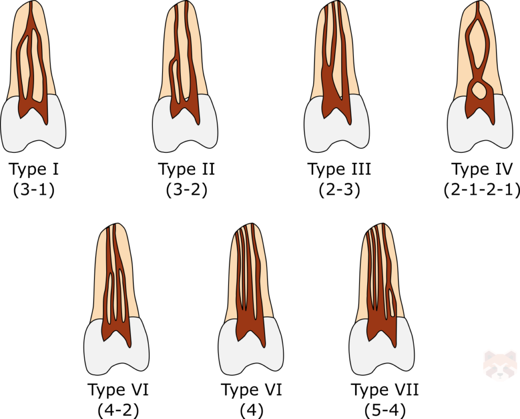 Gulabivala canal configurations