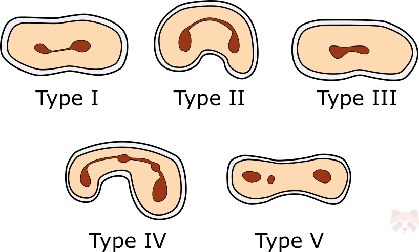 Kim Isthmus classification
