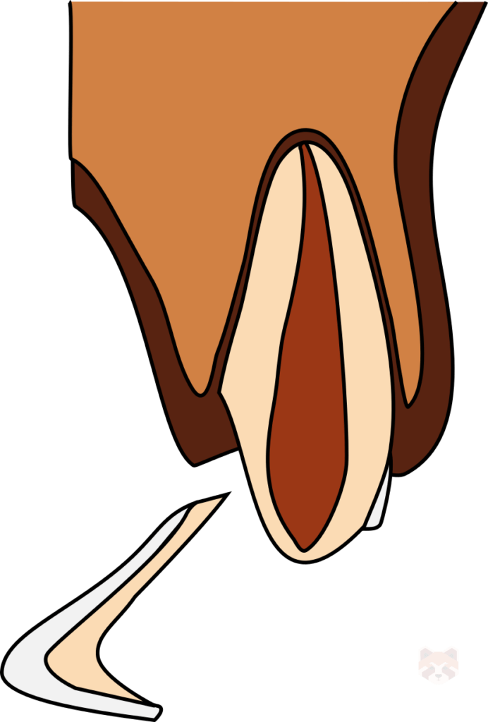 Uncomplicated crown root fractures 1