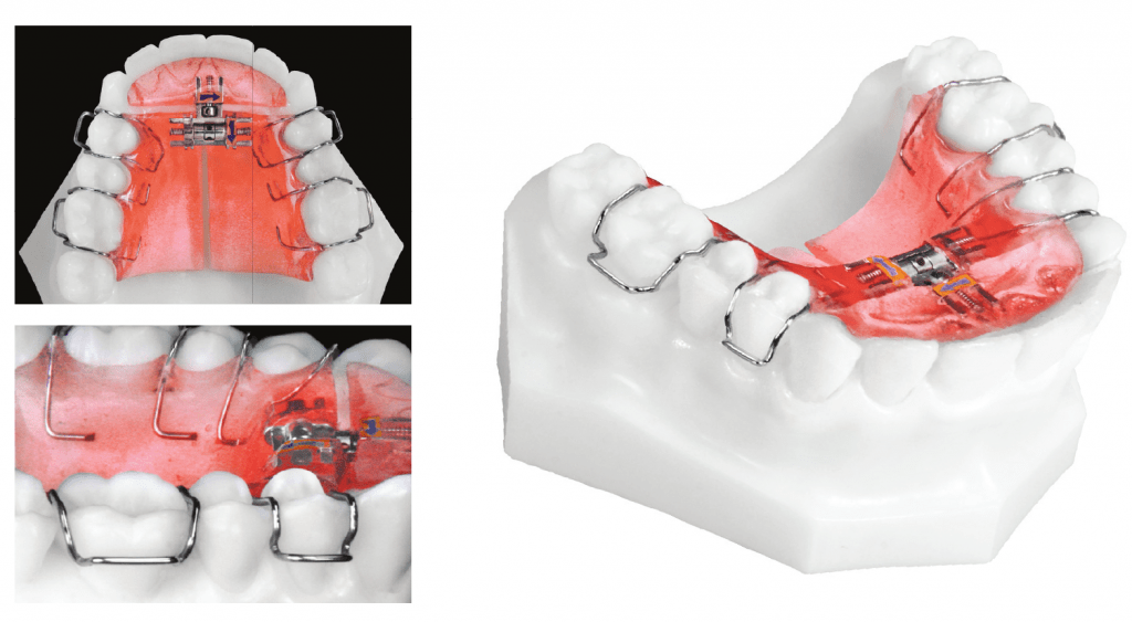 3 way expander 1024x563 1