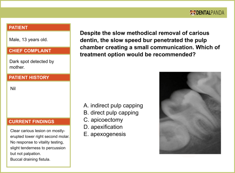 ADJUNCT ENDODONTIC PROCEDURES - Apexification