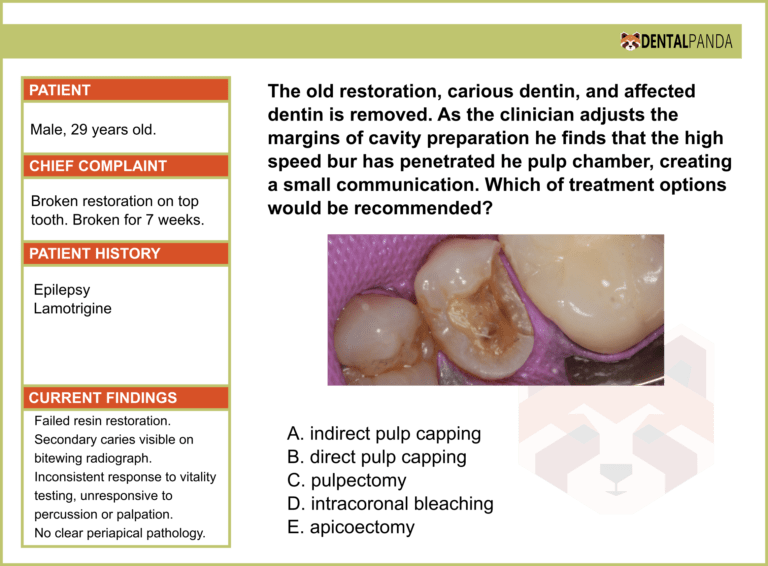 ADJUNCT ENDODONTIC PROCEDURES - direct pulp cap