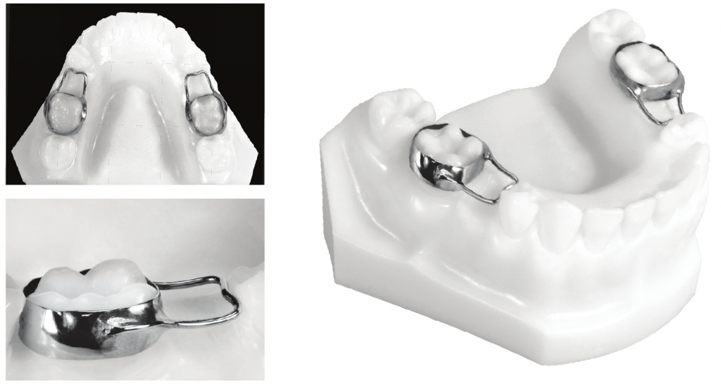 Band and loop 1024x548 1