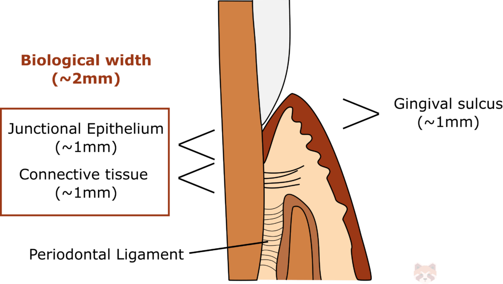 Biological width 1 1024x579 1