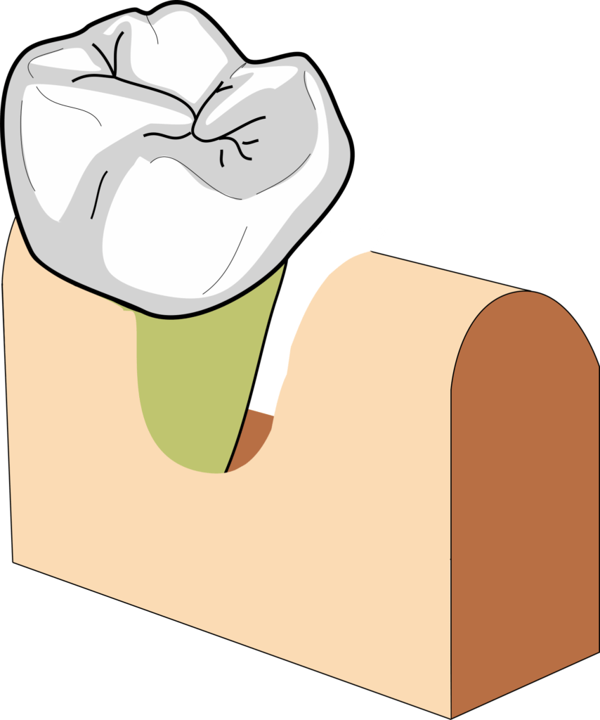 Bony defects 1 wall 854x1024 1