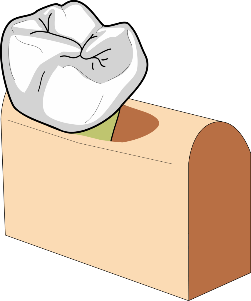 Bony defects 3 wall 854x1024 1