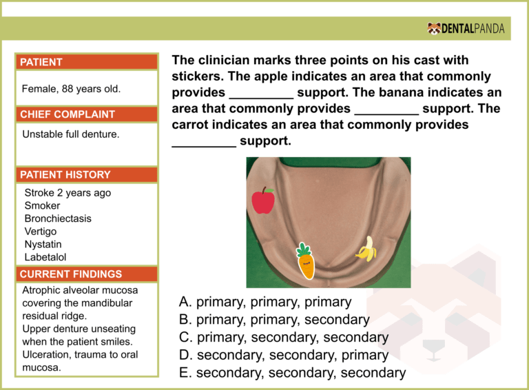 COMPLETE DENTURES - support 2