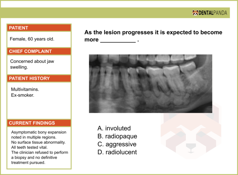 CONNECTIVE TISSUE LESIONS - Florid Cemento-osseous Dysplasia 2