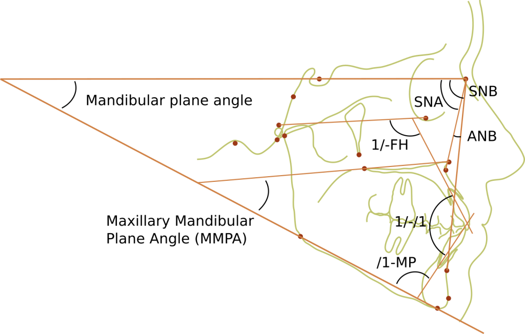 Ceph tracing angles and labels 1024x652 1