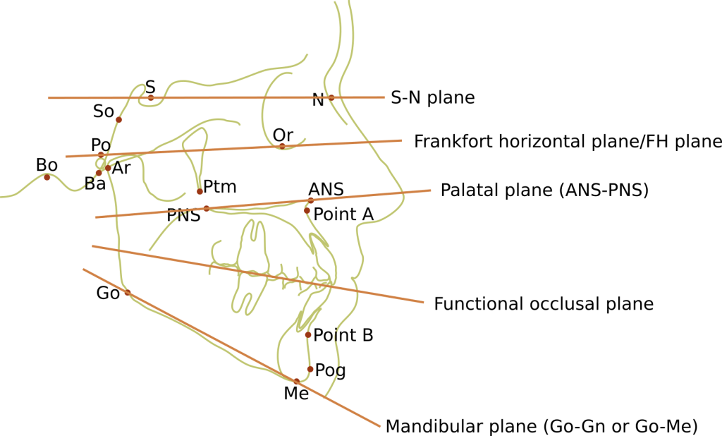 Ceph tracing planes and labels and points labelled 1024x618 1