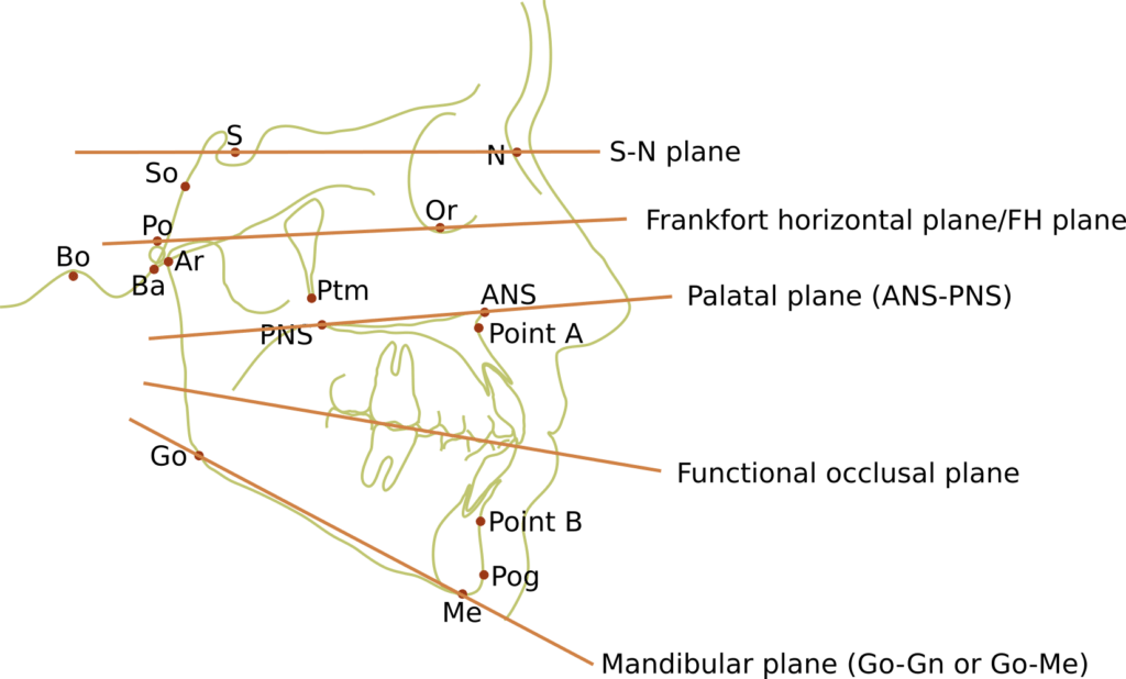 Ceph tracing planes and labels and points labelled 1024x618 2