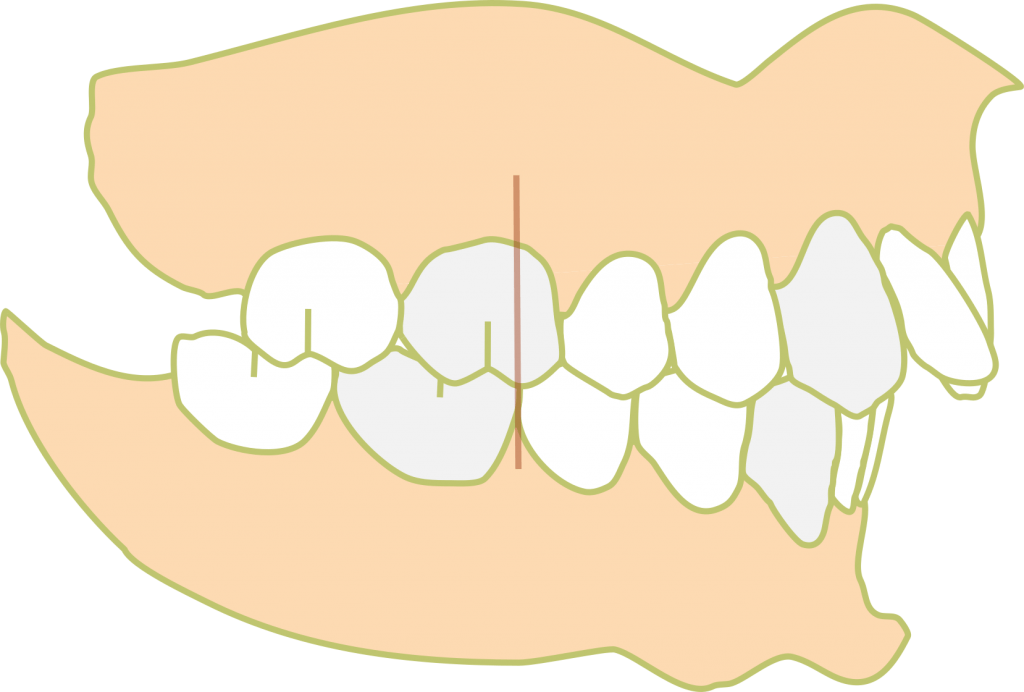 Class II Div 2 1024x692 1