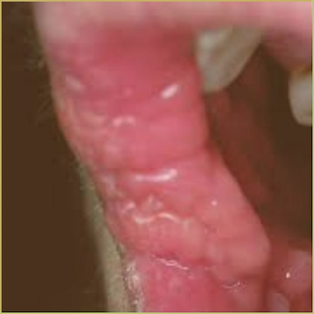 Crohns Disease 4 1024x1024 1