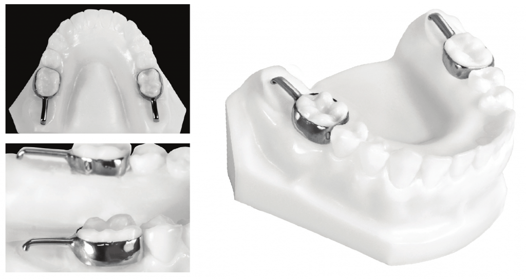 Distal shoe 1024x544 1