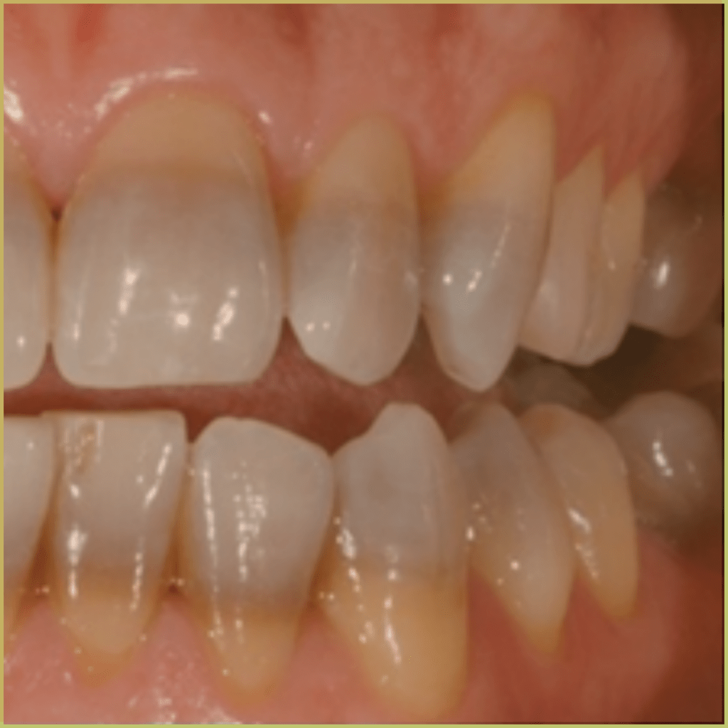 Drug induced pigmentation 4 1024x1024 1