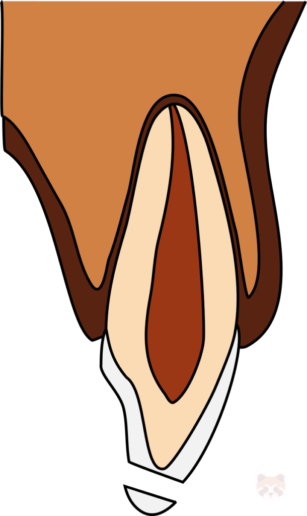 Enamel only fracture 2 610x1024 1