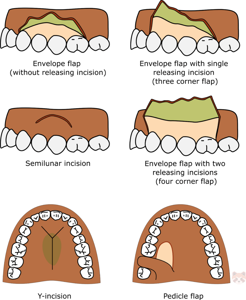 Envelope flap 1 840x1024 1