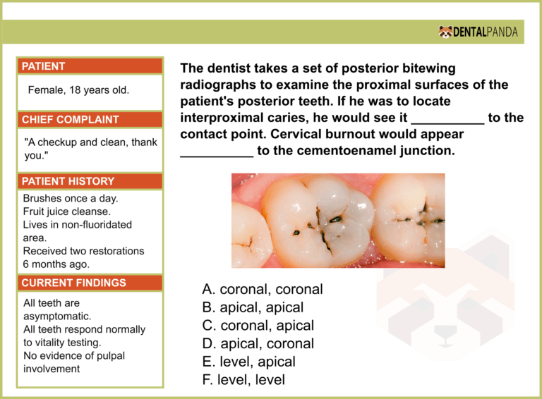 Exam - If he was to locate interproximal caries, he would see it