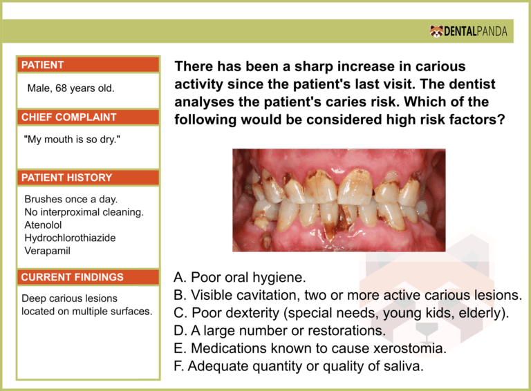 Exam - Which of the following would be considered high risk factors