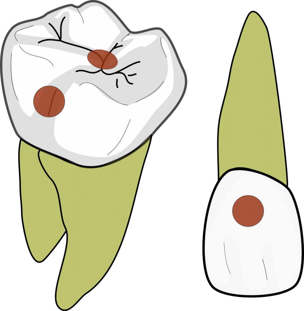 GV Black class 1 1 1000x1024 1