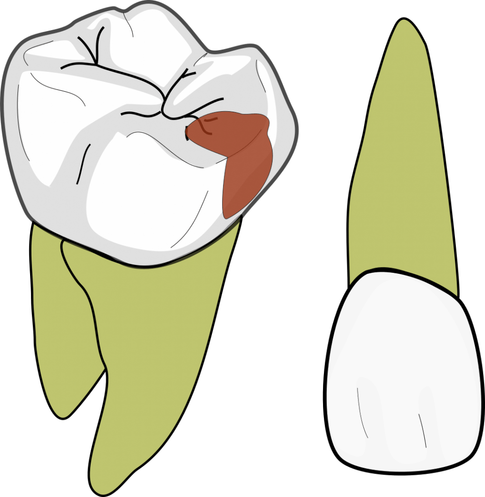 GV Black class 2 1000x1024 1