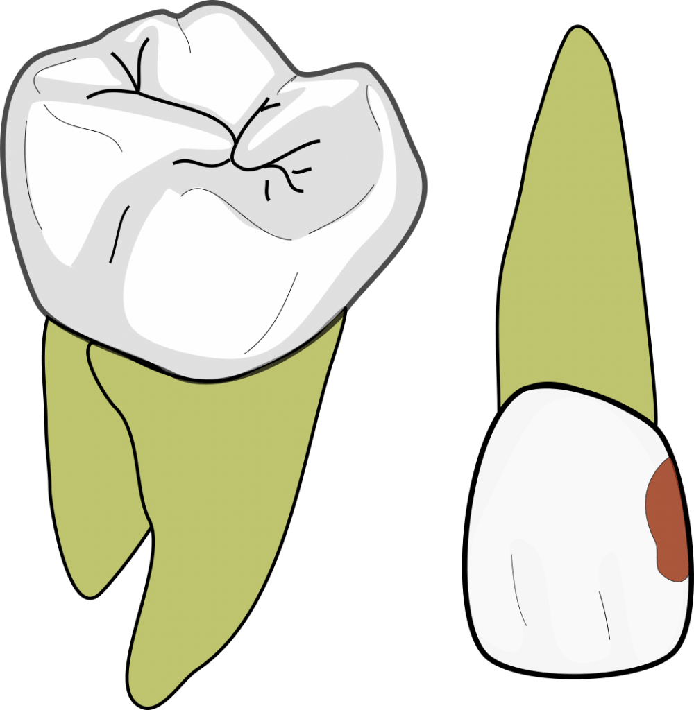 GV Black class 3 1 1000x1024 1