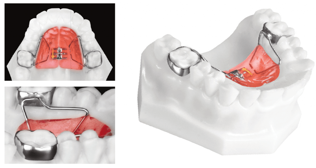 Haas appliance 1024x546 1