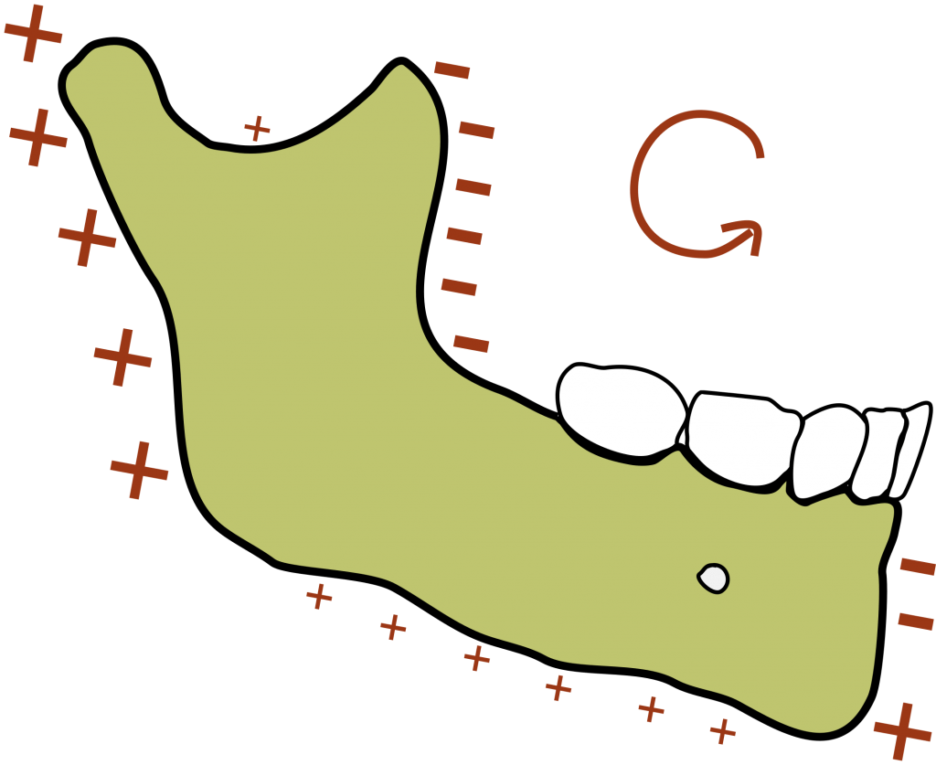 Kids mandibular growth illustrated 1 1024x837 1