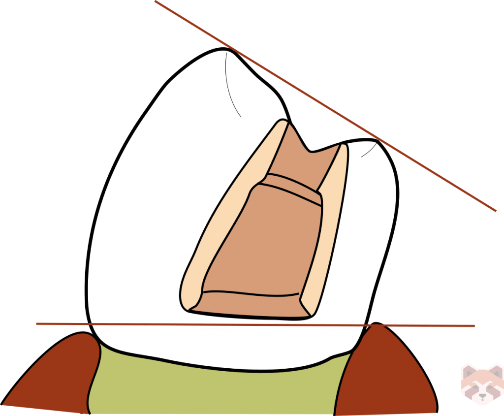 Mandibular first premolar 1024x845 1