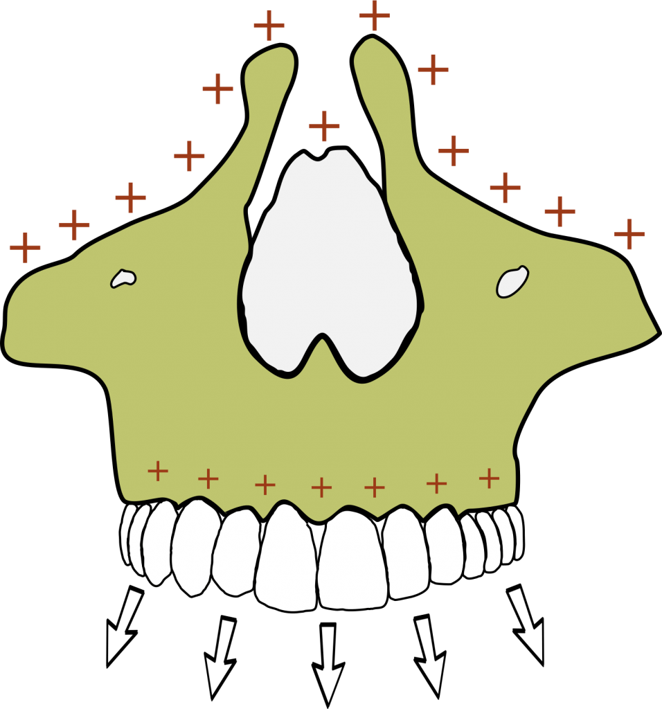 Maxilla anterior view illustrated 956x1024 1