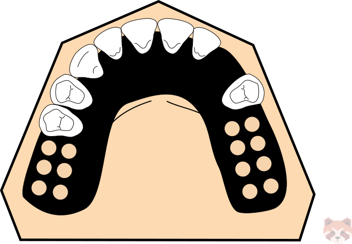 Maxillary connector horseshoe