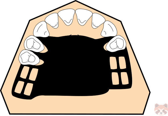 Maxillary connector palatal plate