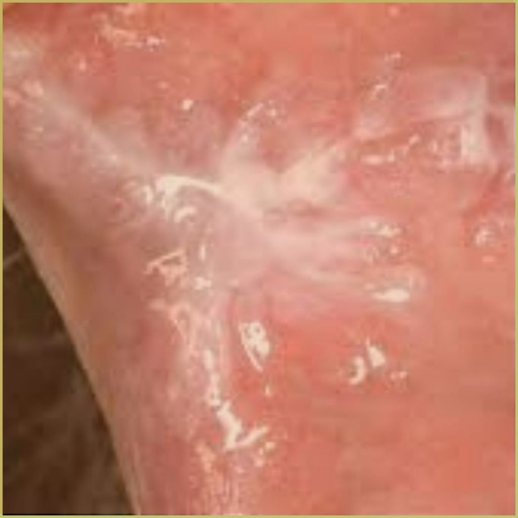 Morsicatio 1 1024x1024 1