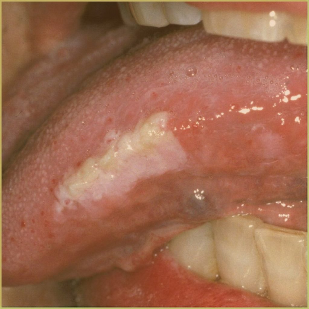 Morsicatio 3 1024x1024 1