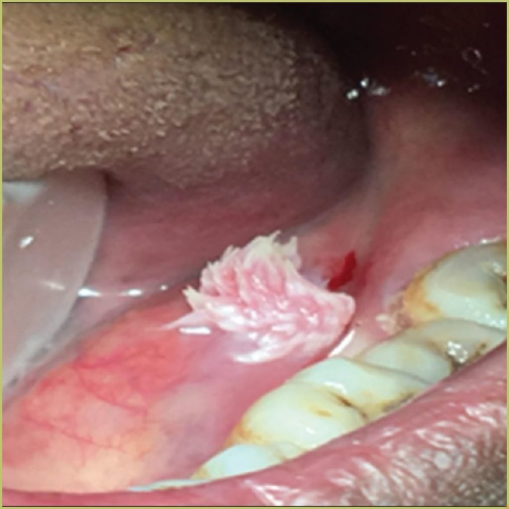 NigerJClinPract 2019 22 3 439 253453 f3 1 1024x1024 1