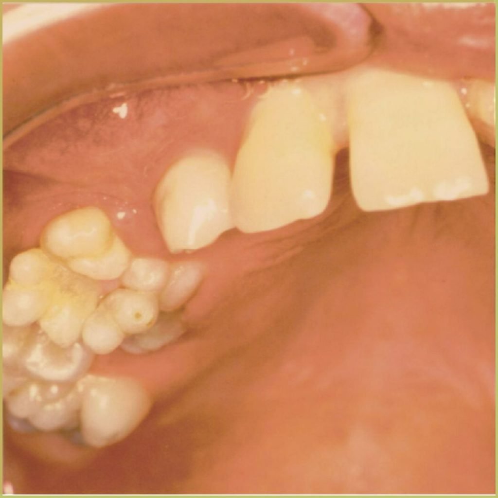 Odontomas 1 1024x1024 1