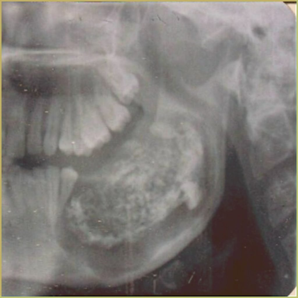 Odontomas 2 1024x1024 1