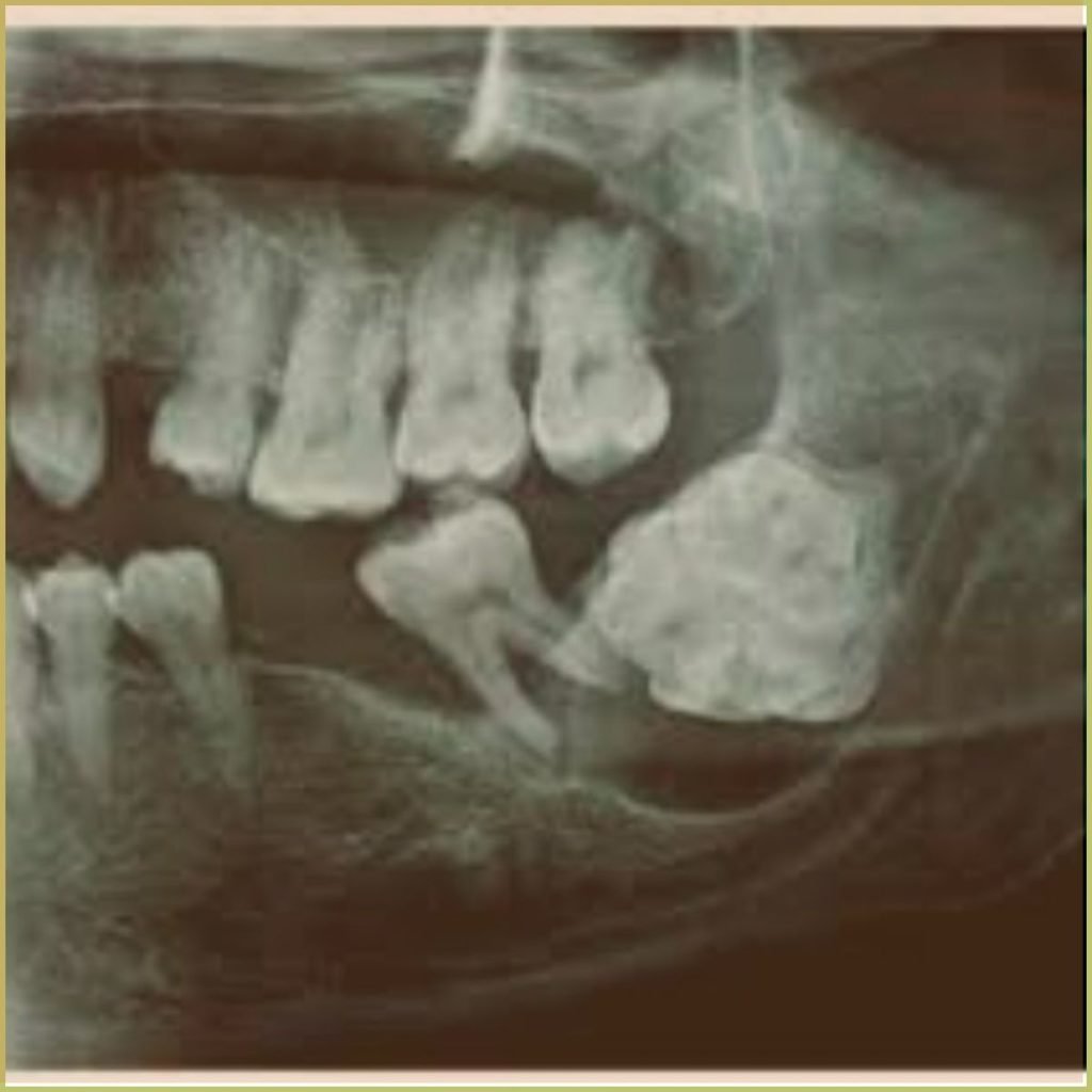 Odontomas 3 1024x1024 1