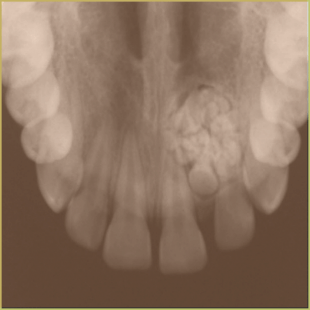 Odontomas 4 1024x1024 1