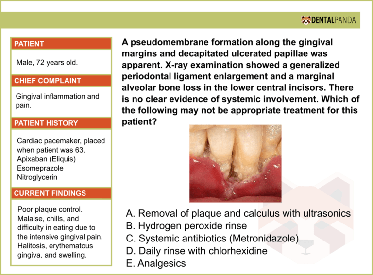 PERIODONTAL TREATMENTS - ANUG