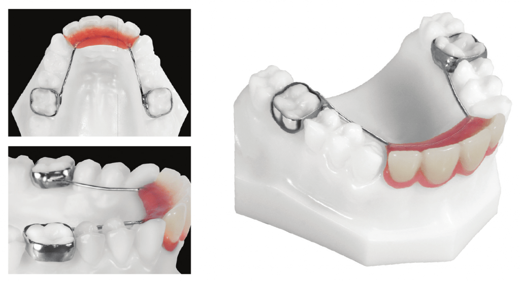 Pedo partial 1024x555 1