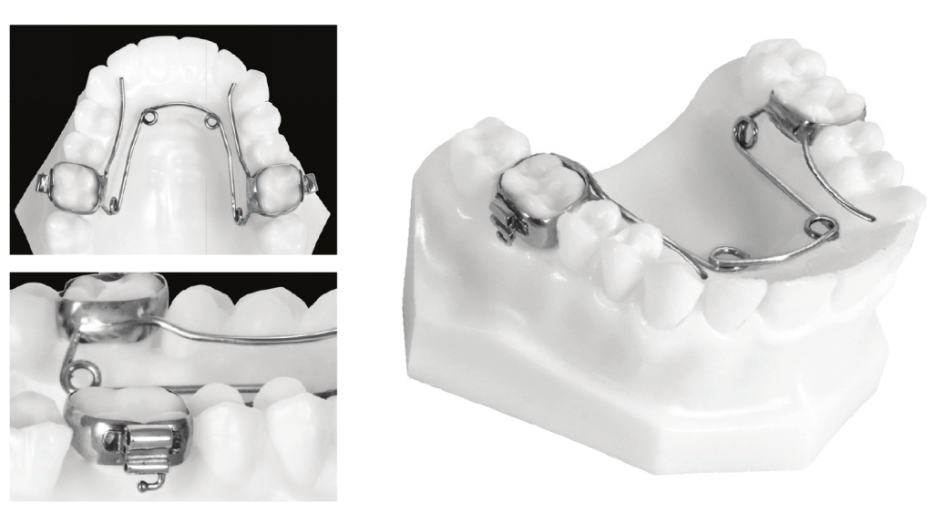 Quad helix 1024x564 1