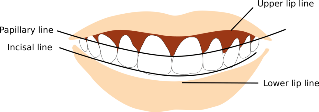 Smile line 1024x361 2