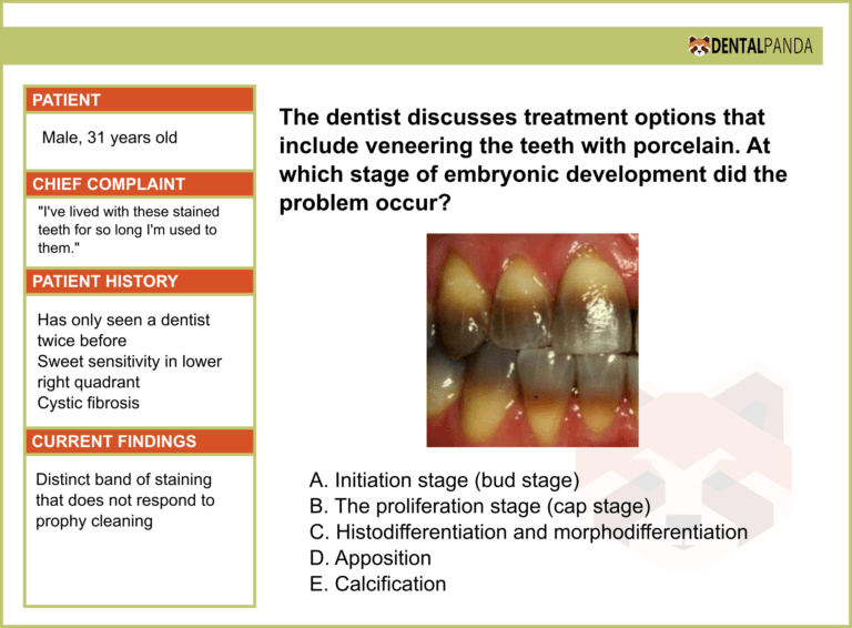 The dentist discusses treatment options that include veneering the teeth with porcelain