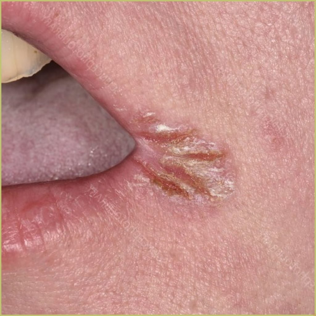 c0472876 800px wm 1 1024x1024 1