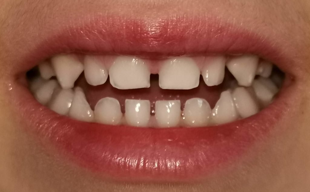 logan teeth 1024x635 1